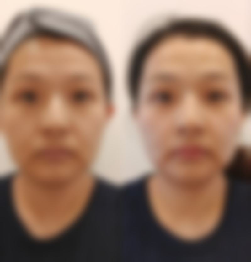 南宁市第一人民医院整形美容外科实例参考