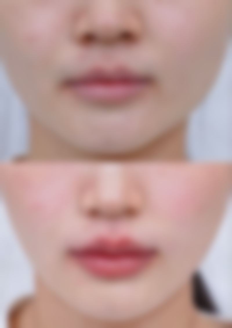 丁雪娟擅长项目列表