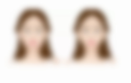 盐城建湖县中医院医疗美容科价格表（仅供参考）