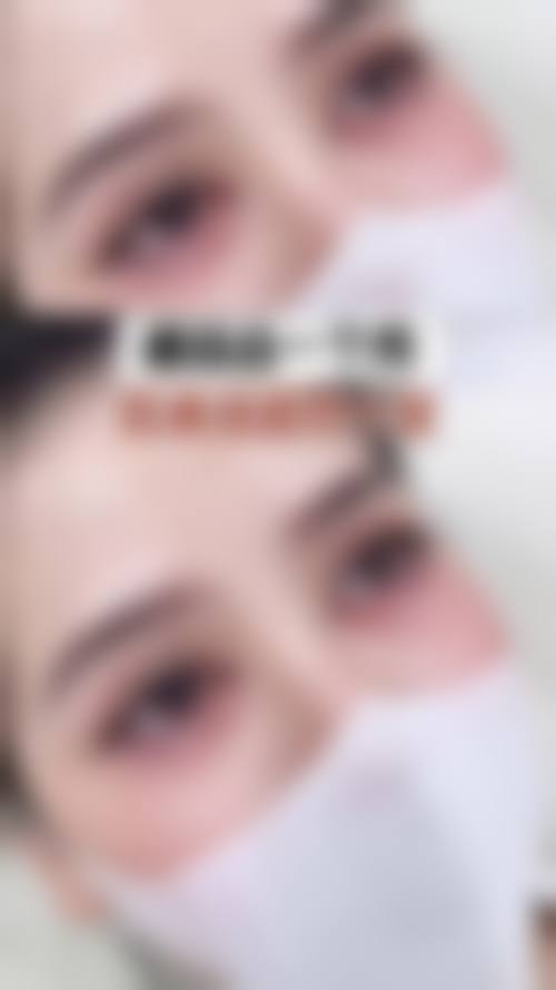 深圳博美医疗美容医院实例参考