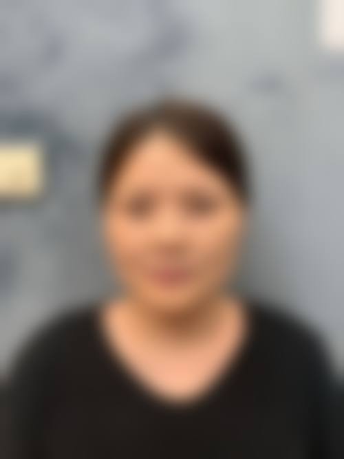 盐城建湖县中医院医疗美容科怎么预约？