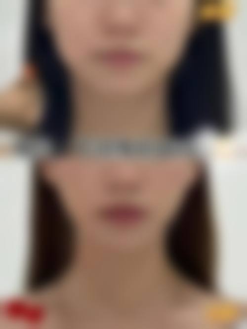 盐城建湖县中医院医疗美容科医生有哪些？