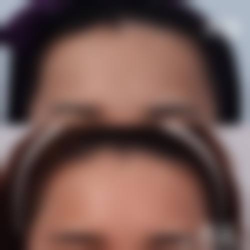 盐城建湖县中医院医疗美容科实例参考