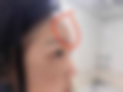 盐城建湖县中医院医疗美容科擅长项目