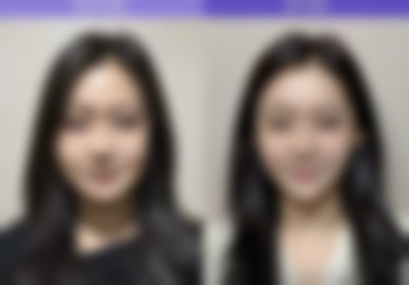 韩国liflltox丽菲尔特皮肤科擅长项目