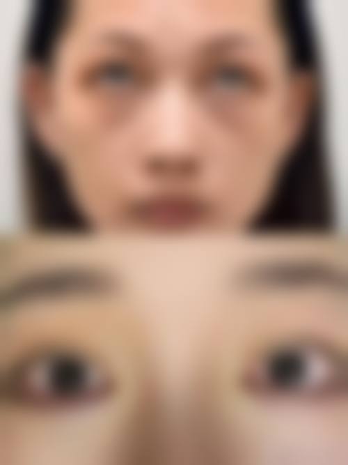 沈阳鑫杏林美容医院价格表（仅供参考）