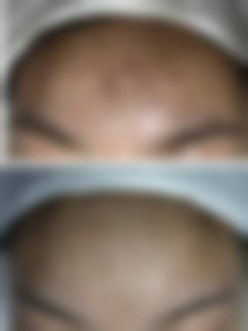 南宁首大医院医疗美容科价格表（仅供参考）