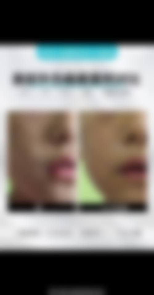 山西医 科 大学非常好医院怎么预约？