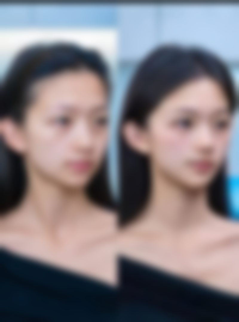 蚌埠医学校附属医院整形外科实例参考