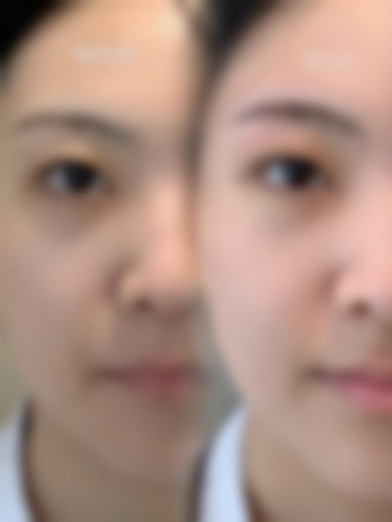 十堰市太和医院美容诊所价格表（仅供参考）