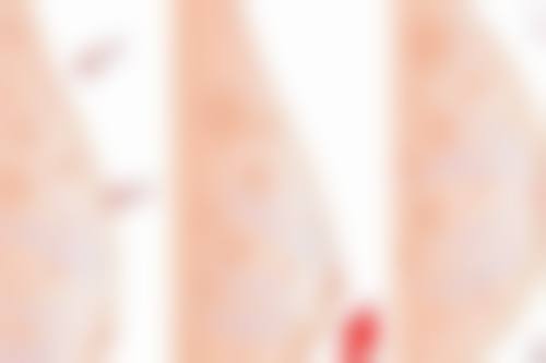 宁波友好医院整形美容中 心怎么预约？