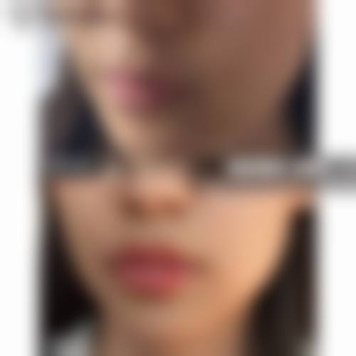 浙江杭州维娜医疗整形擅长项目