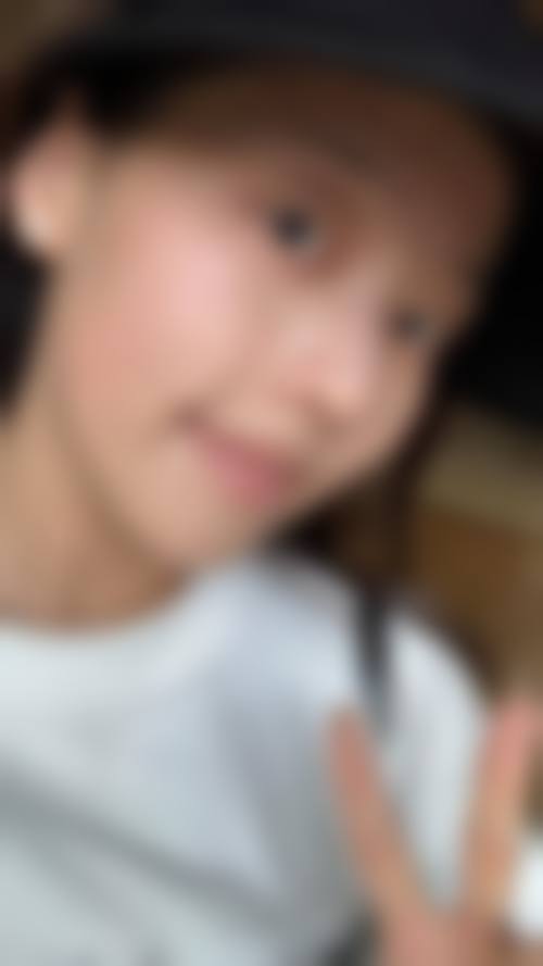 宁波友好医院整形美容中 心实例参考