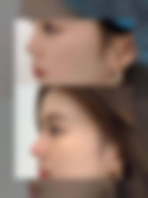 合肥申诚整形美容医院价格表（仅供参考）