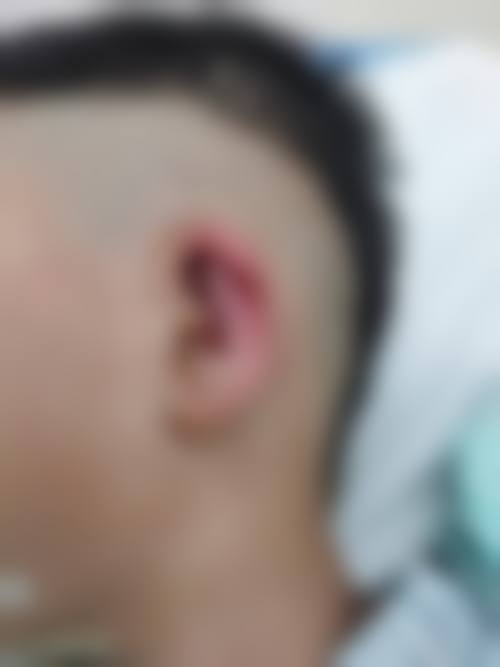 石阡县人民医院怎么预约？