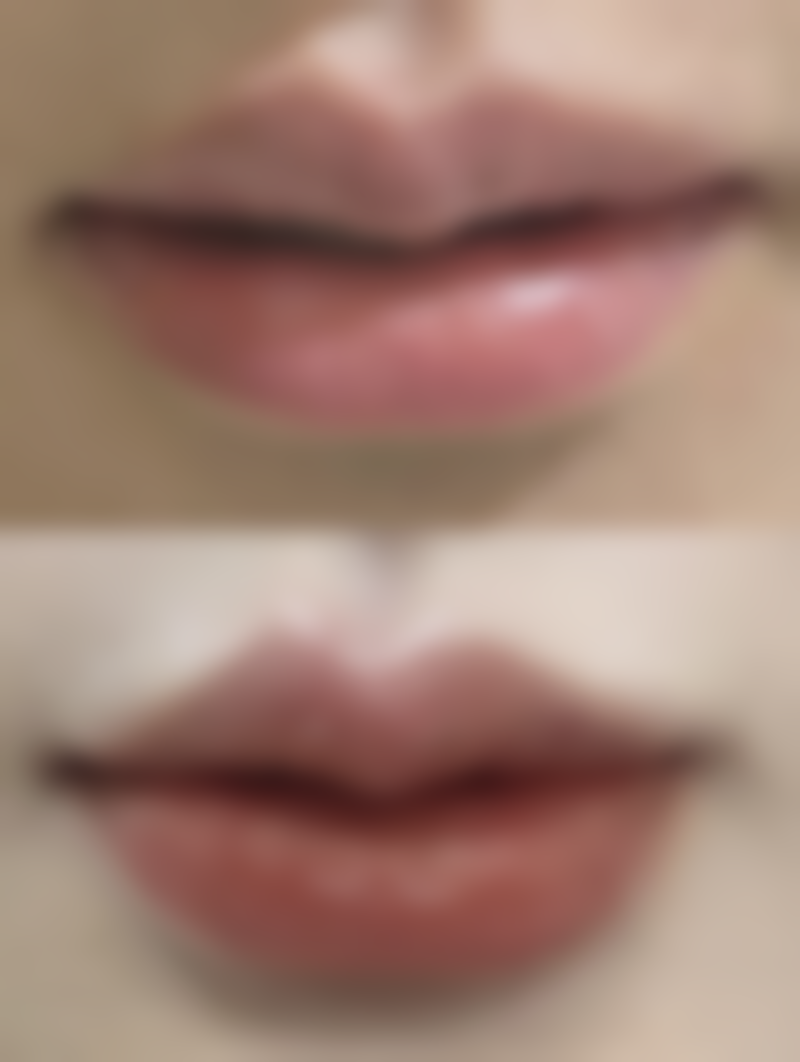 李斗阳患者评价