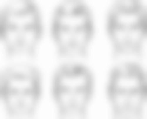 温州鹿城恒美医疗美容门诊部价格表（仅供参考）