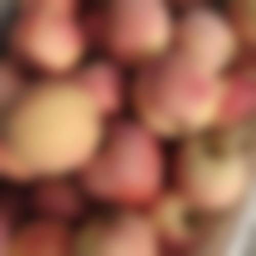 宁夏银川首欣植发价格表（仅供参考）