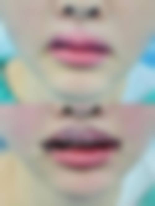 广汉金宗磊整形医院价格表（仅供参考）