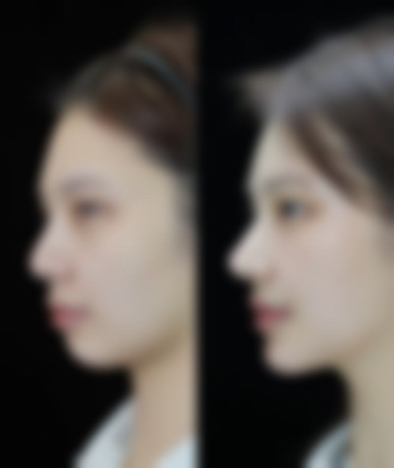 西安星颜靓影医疗美容诊所价格表（仅供参考）