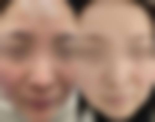 北京名媛芊丽整形医疗美容诊所实例参考