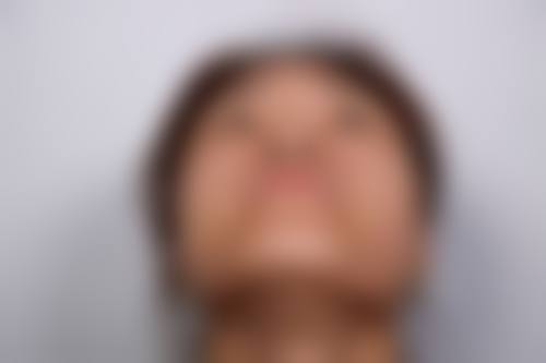 珠海馨悦医疗美容诊所实例参考