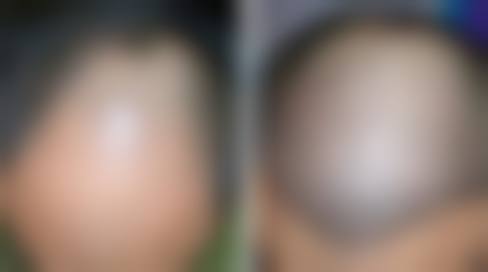 南京瑞丽诗植医疗美容诊所擅长项目