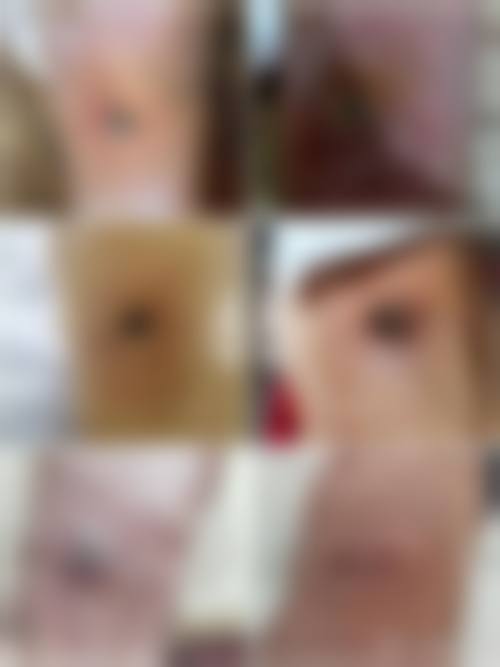 攀枝花市中医和西医结合医院(美容中 心)价格表（仅供参考）