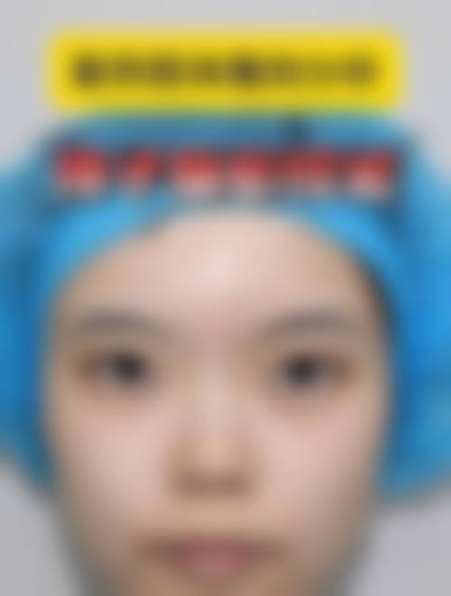 吕梁丽都整形医院价格表（仅供参考）