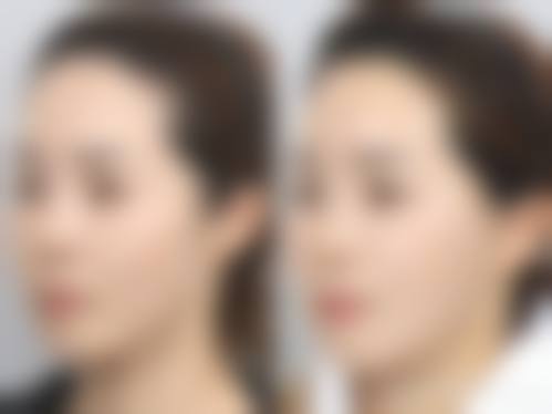 上海玺美医疗美容门诊部实例参考