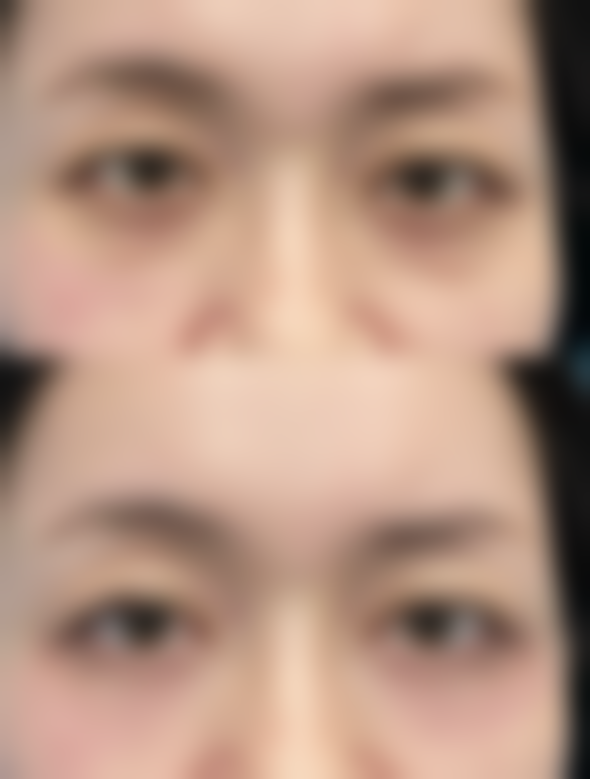 福州华仁整形医院怎么预约？