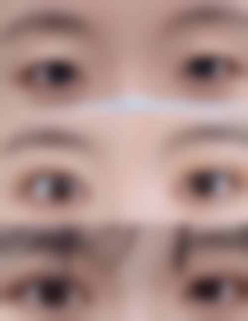 西安美菁颜整形医院擅长项目