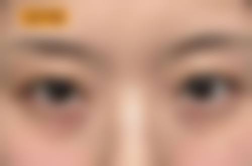 浦江朱美姣整形医疗美容诊所实例参考