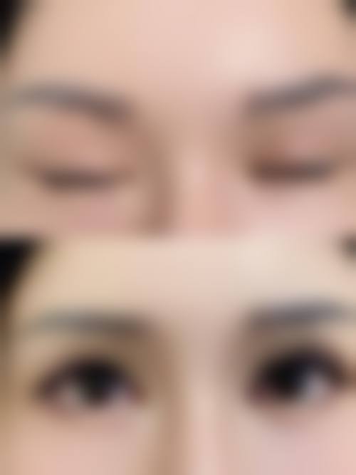 广州瑞丽诗医疗美容诊所实例参考