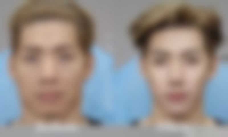 成都丽身国内外整形擅长项目