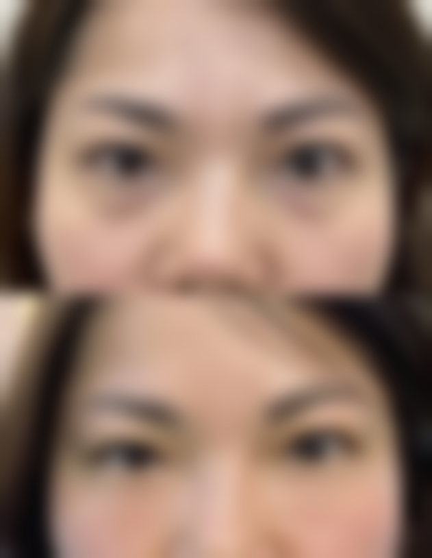 西安美菁颜整形医院怎么预约？