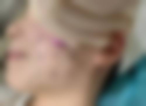 上海米颂医疗美容门诊部怎么预约？