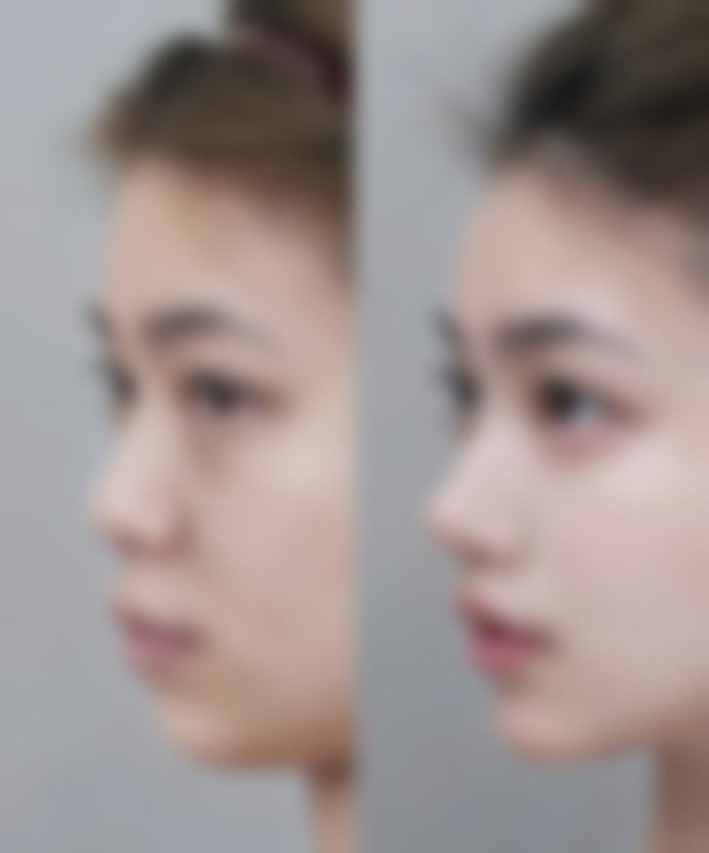 鞍山任凌莘美容诊所怎么预约？