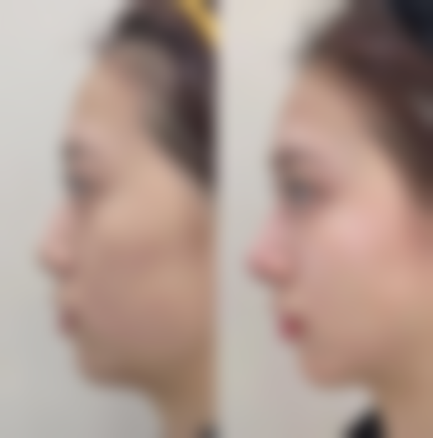 陇南逆吋光医疗美容诊所怎么预约？