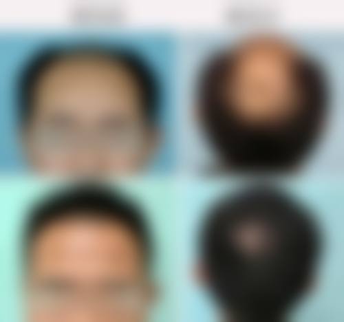 南阳约美医疗美容门诊部价格表（仅供参考）