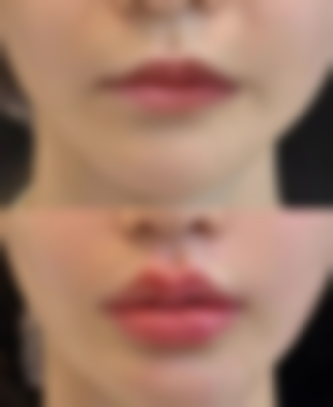 惠州优漾医疗美容诊所擅长项目