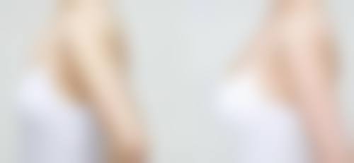 郑州诺亚医疗美容门诊部价格表（仅供参考）