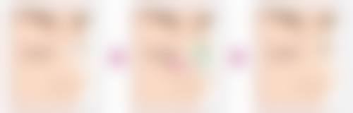 湖州唯美医疗美容口腔门诊部价格表（仅供参考）