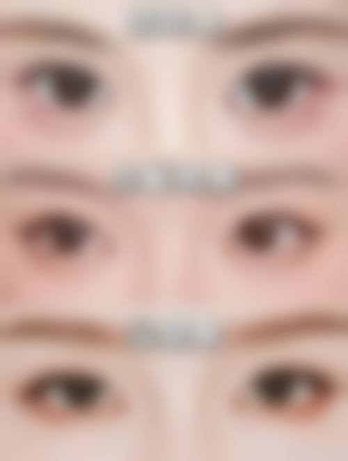 洛阳协和医疗美容门诊部擅长项目