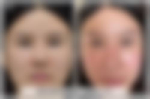 西安瑞美佳人医疗美容门诊部怎么预约？