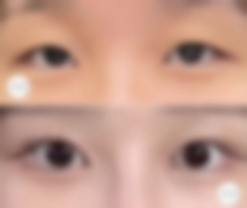 韩国琉璐珍整形医院价格表（仅供参考）