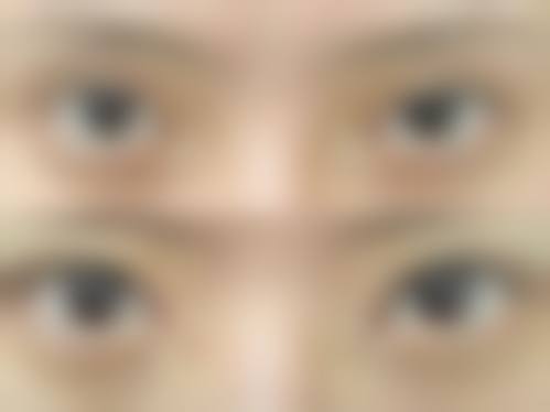 新疆医 科 大学第五附属医院整形美容科擅长项目