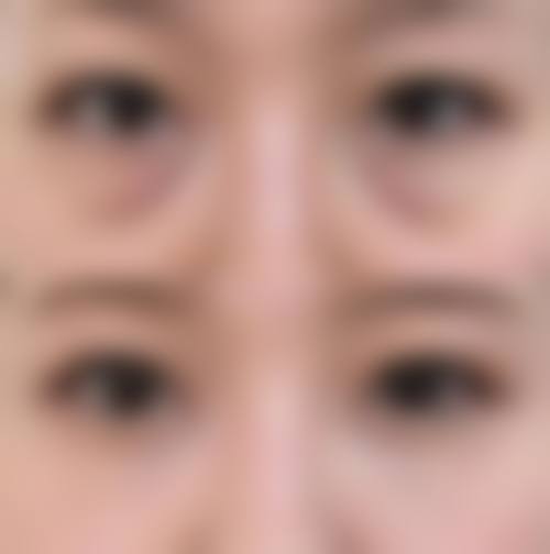 北京京煤集团总医院整形外科实例参考