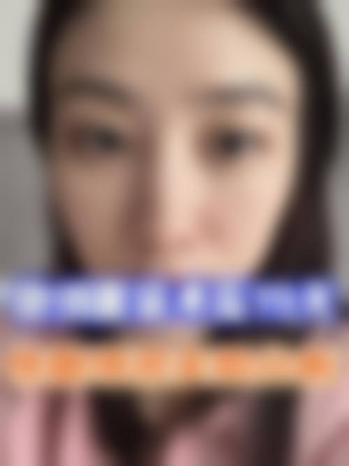 深圳常安整形医院实例参考