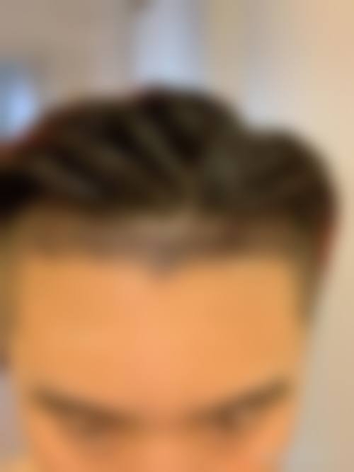 上饶安美菲丽整形医院价格表（仅供参考）